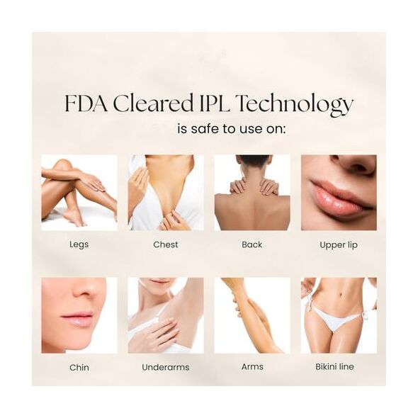 MAC Appareil D'épilation MAC MC-33 (900 000 Impulsions)