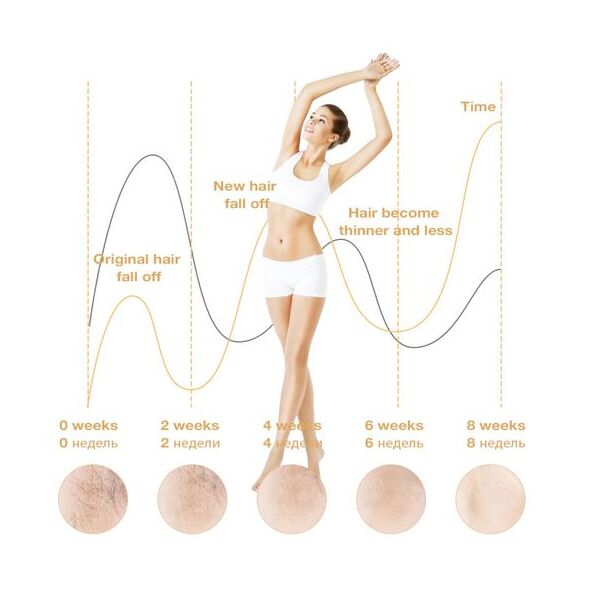 MAC Appareil D'épilation MAC MC-33 (900 000 Impulsions)